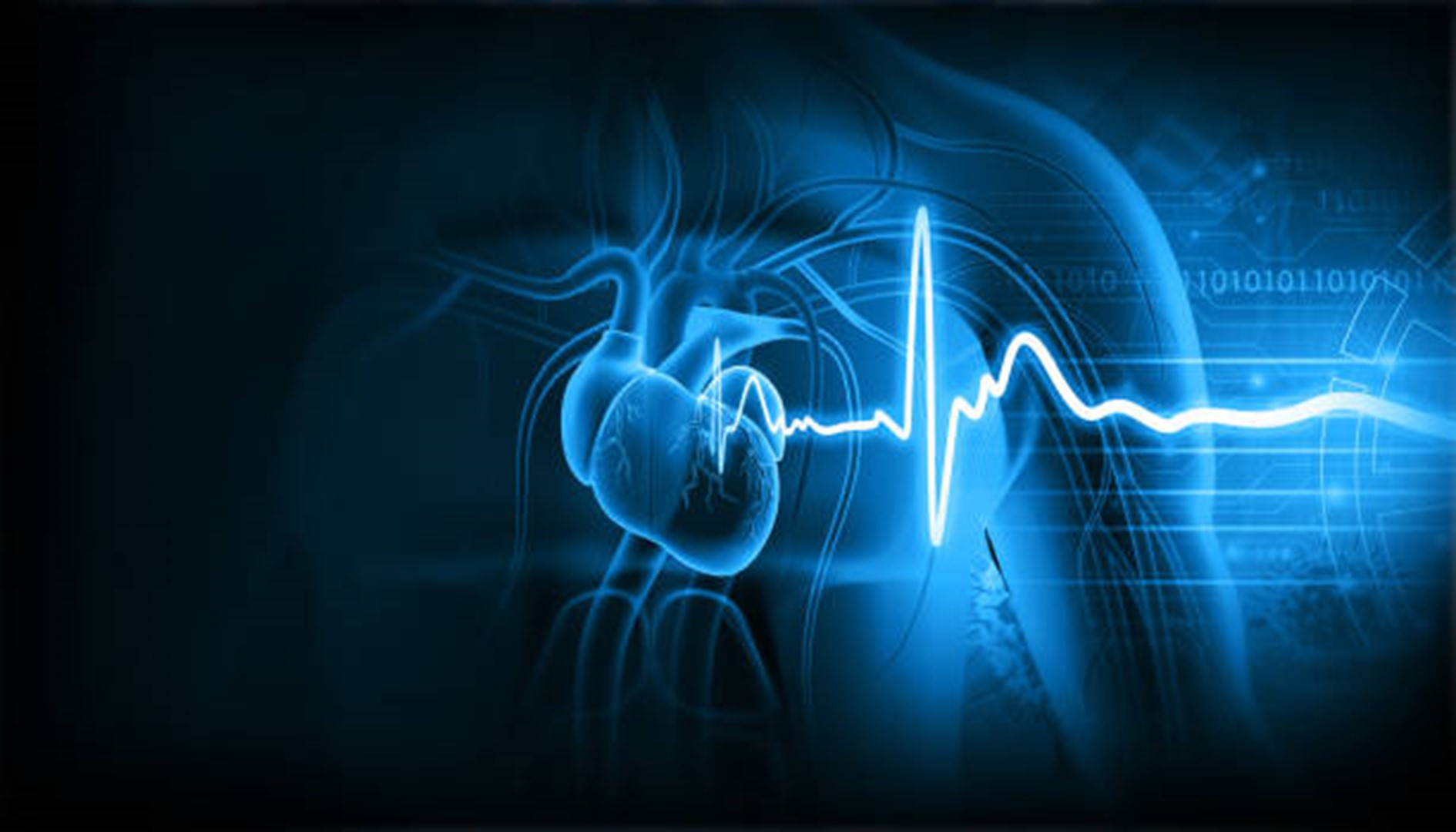 Do Ecgs Detect Heart Attacks